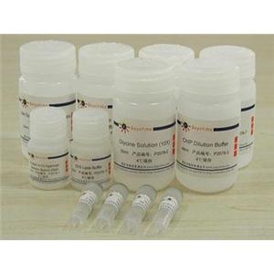 ChIP Assay Kit