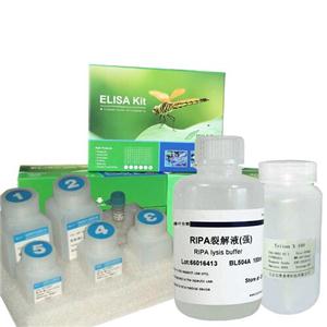 三合一RNA上樣液（含EB，RNA Loading Buffe）