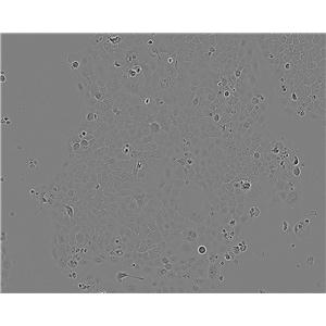 NCTC 1469 Cell:小鼠正常肝細(xì)胞系