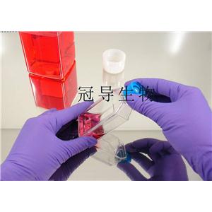 SU-DHL-1人間變性大細(xì)胞淋巴瘤復(fù)蘇細(xì)胞(附STR鑒定報告)