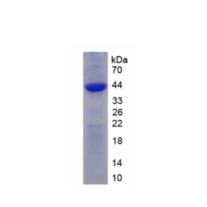 受體活性修飾蛋白2(RAMP2)重組蛋白