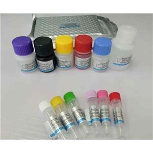 人巨噬細胞炎癥蛋白1β（MIP-1β/CCL4）Elisa試劑盒
