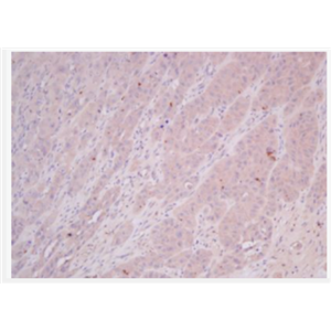 Anti-COMMD4 antibody-COMM結(jié)構(gòu)域蛋白4抗體