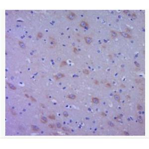 Anti-EGF  antibody-表皮生長(zhǎng)因子抗體