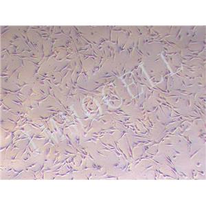 U-138MG人腦星形膠質(zhì)母細胞瘤