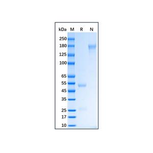 aladdin 阿拉丁 Ab175962 Pig IgG ≥ 95%; Isotype Control Antibody; Pig IgG; Unconjugated