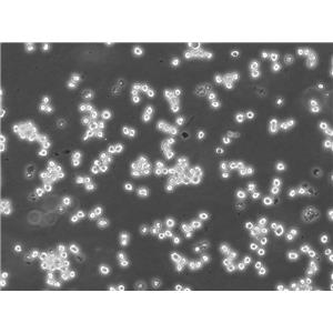 Calu-6人退行性癌復蘇細胞|STR基因圖譜