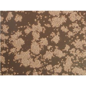 DLD-1 Cells人結(jié)直腸腺癌上皮細(xì)胞|送STR圖譜