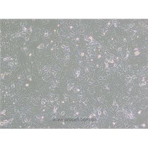 BHT101細胞 (人甲狀腺癌細胞(未分化)) (STR鑒定正確)CL-0617